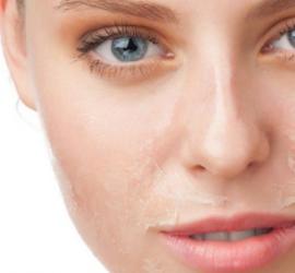 Пилинг для сухой кожи лица: важные советы и ценные рецепты Пилинги для увлажнения кожи